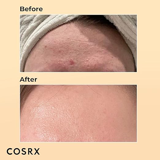 COSRX 96% Snail Mucin Repair Essence 100ml Moisturizing Face Serum for Dull Skin